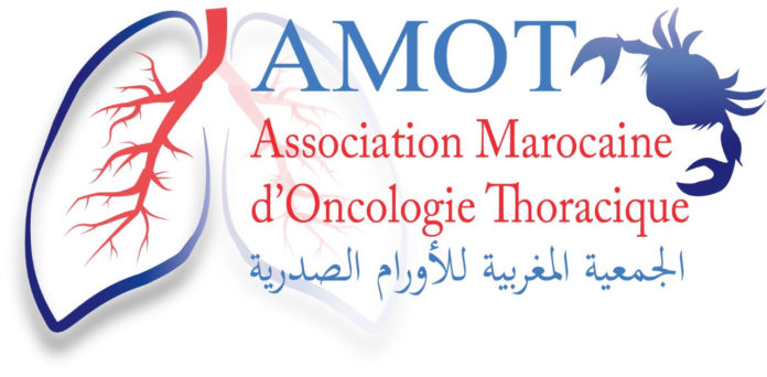 L’Association Marocaine d’Oncologie Thoracique publie ses recommandations pour la prise en charge des personnes atteintes du cancer du poumon durant la pandémie du Covid-19