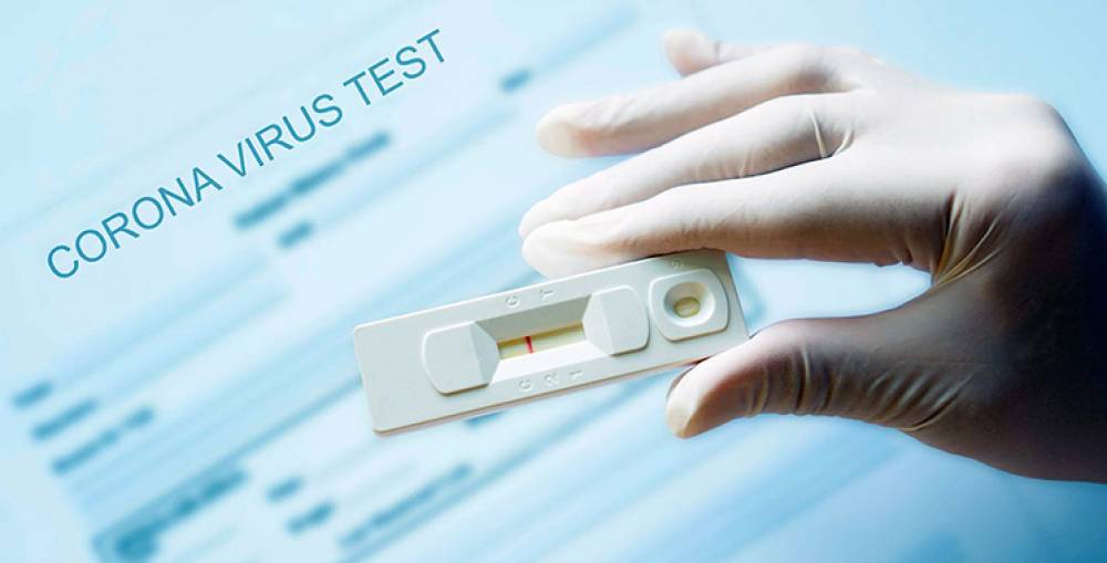 Tests PCR : La CGEM réclame une baisse des tarifs