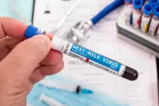 France : des cas autochtones du virus "West Nile" détectés en région parisienne