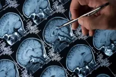 USA: Une découverte d’un éminent professeur marocain promet de révolutionner le dépistage d’Alzheimer