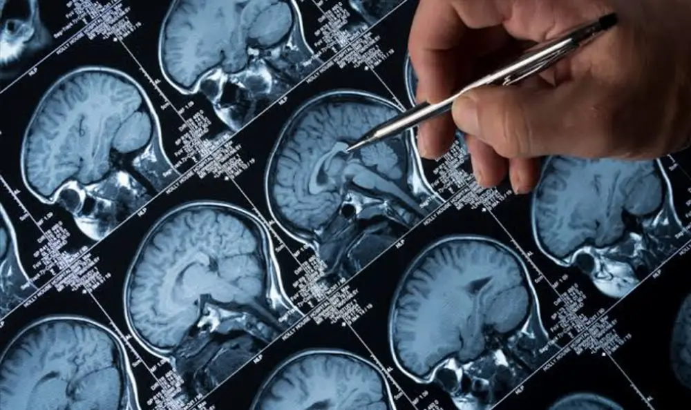 USA: Une découverte d’un éminent professeur marocain promet de révolutionner le dépistage d’Alzheimer