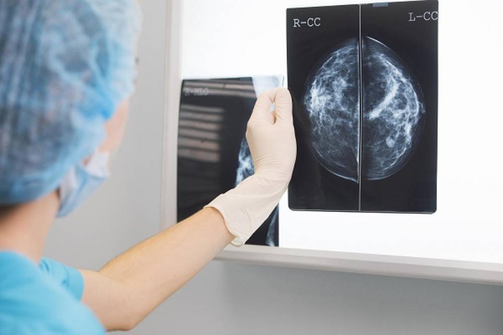 Augmentation des cancers diagnostiqués grâce à une stratégie améliorée