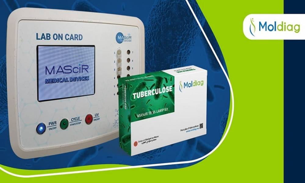 MAScIR lance le premier test de diagnostic de la tuberculose 100% marocain