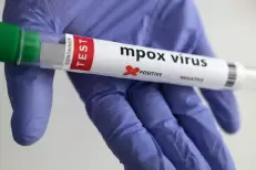 Un premier cas du nouveau variant du Mpox identifié en France