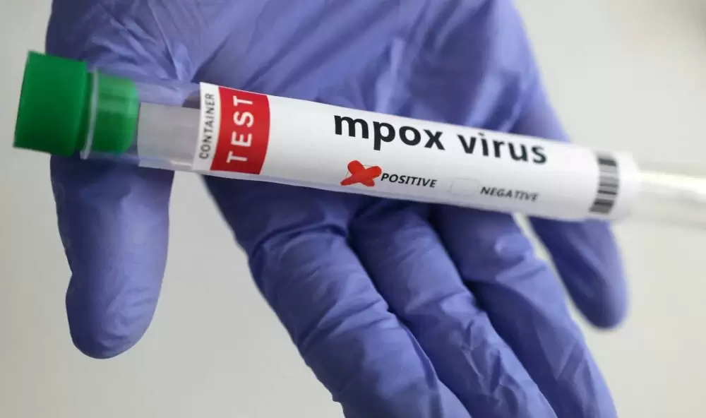 Un premier cas du nouveau variant du Mpox identifié en France