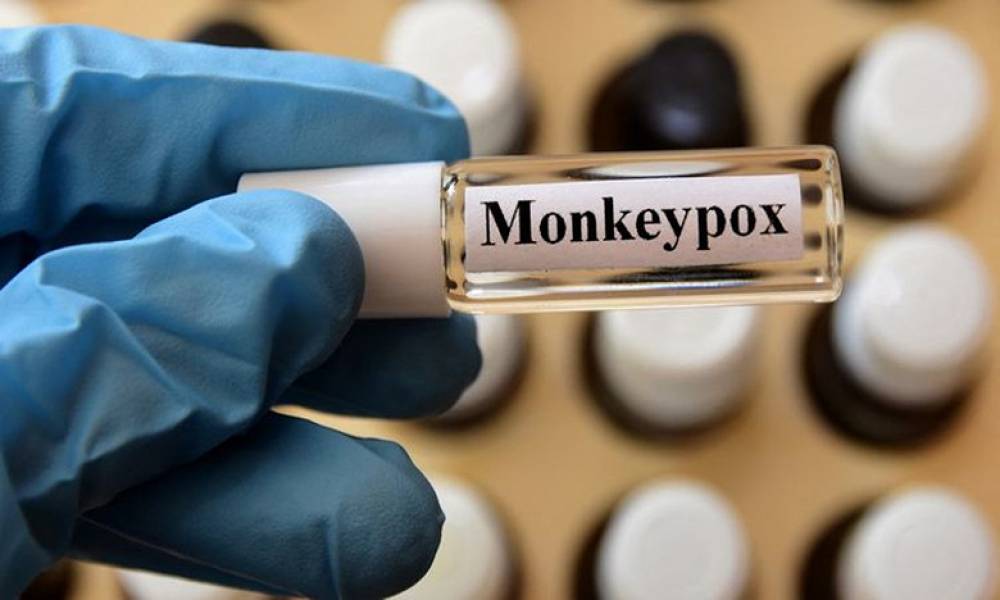 Variole du singe: L’UE va acheter 110.000 vaccins pour lutter contre l’épidémie