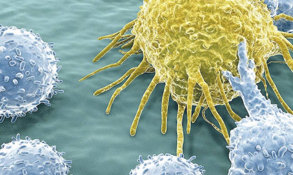 L'efficacité de l'immunothérapie du cancer peut être augmentée (chercheurs belges)