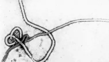 Ebola : un premier cas confirmé en France chez un...
