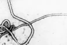Ebola : un premier cas confirmé en France chez un médecin de retour de RDC