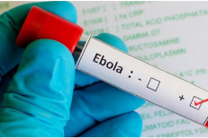 Le plan continental de lutte contre Ebola nécessite 1,4 milliard de dollars