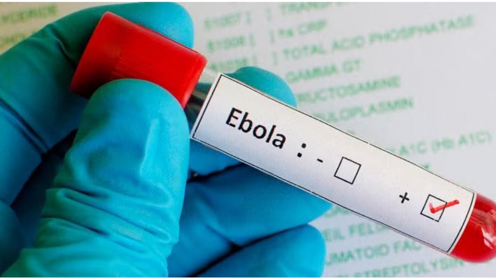 Le plan continental de lutte contre Ebola nécessite 1,4 milliard de dollars