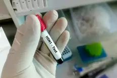 Grippe aviaire : l’OMS juge "faible" le risque global posé par le virus H5N1