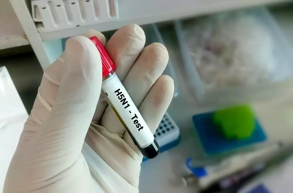 Grippe aviaire : l’OMS juge "faible" le risque global posé par le virus H5N1
