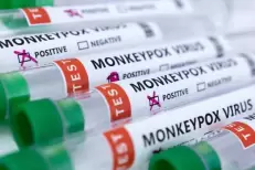L’Afrique du Sud signale un premier cas de variole du singe