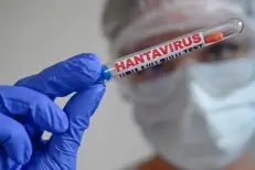Pays-Bas : 12 soignants mis en quarantaine après des erreurs sur un patient atteint d’Hantavirus