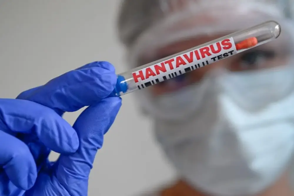 Pays-Bas : 12 soignants mis en quarantaine après des erreurs sur un patient atteint d’Hantavirus