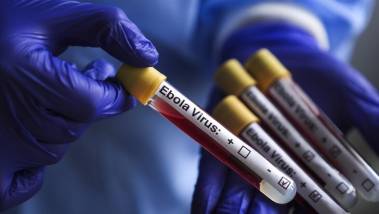 Ebola : CDC Afrique mobilise 1,5 million USD en fa...