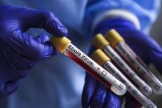Ebola : CDC Afrique mobilise 1,5 million USD en faveur du Kenya