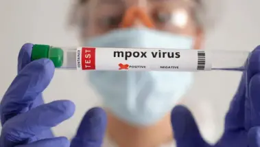 Russie : cinq cas de Mpox confirmés à Saint-Péters...