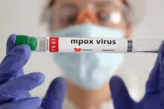 Russie : cinq cas de Mpox confirmés à Saint-Pétersbourg