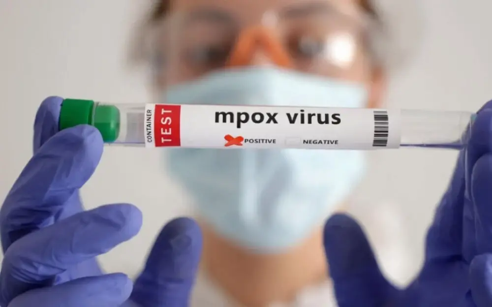 Russie : cinq cas de Mpox confirmés à Saint-Pétersbourg
