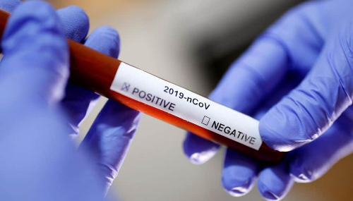 Covid-19 : Les tests désormais élargis aux laboratoires privés de biologie médicale
