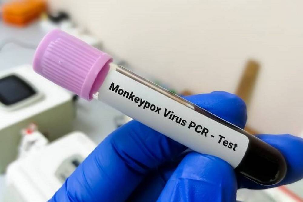 CDC : Le vaccin contre la variole du singe est "très efficace"