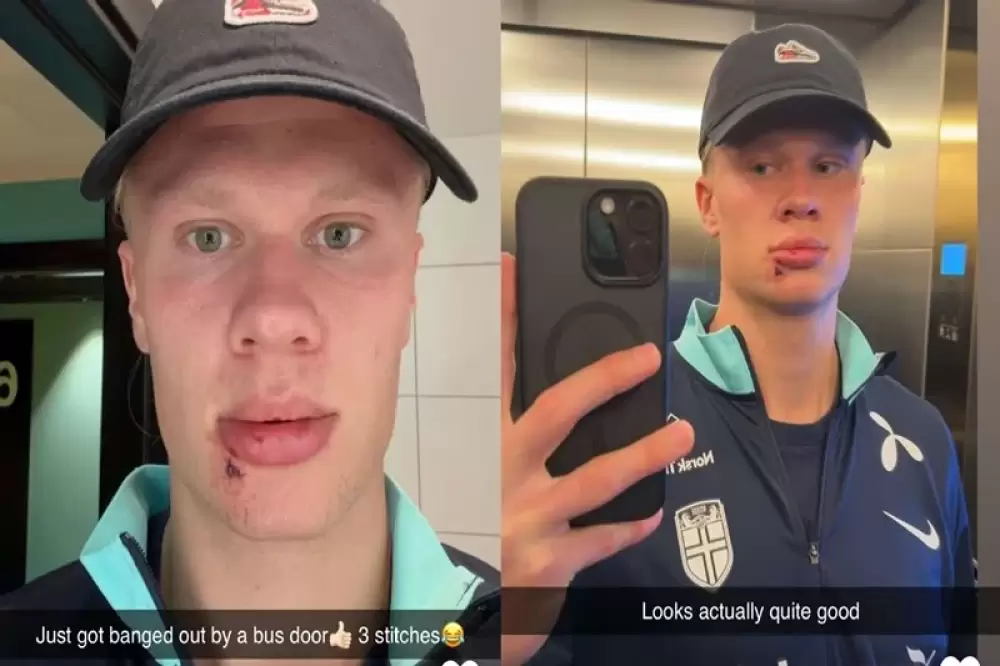Erling Haaland se blesse après s'être heurté à un bus lors de son stage en Norvège