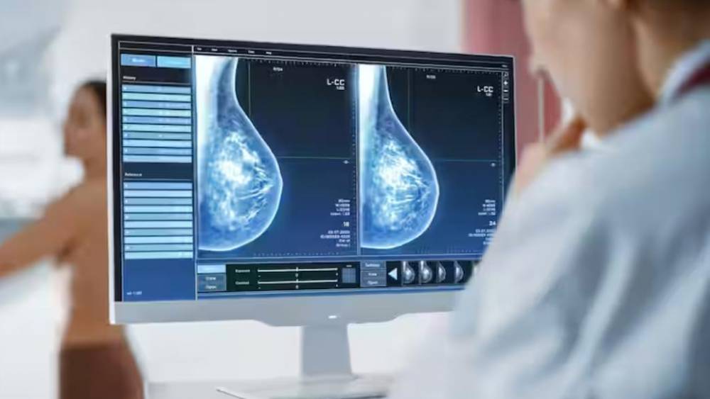 Cancer du sein : les femmes qui ne se font pas dépister tôt ont un risque accru d'en mourir, selon une étude